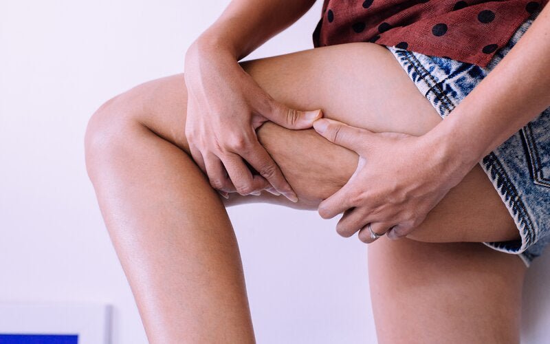 Cellulite: Ursachen, Entstehung und 5 hilfreiche Tipps dagegen - VitalBodyPLUS.de