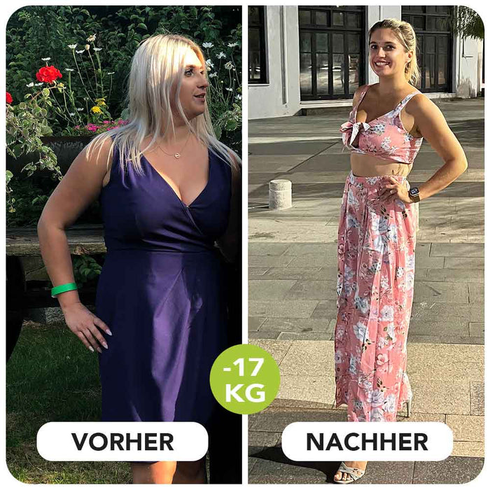 Venice Body Vorher Nachher